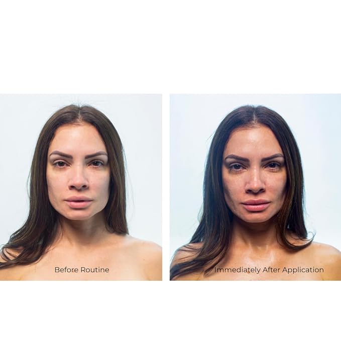 Jorovi Beauty Comprehensive Skincare Set -6- Piece Regimen with Cleanser, Toner, Face Serum, Eye Cream, Facial Moisturizer, and SPF 50 Lotion Kit for Women & Teens (Skin care Gift Set)