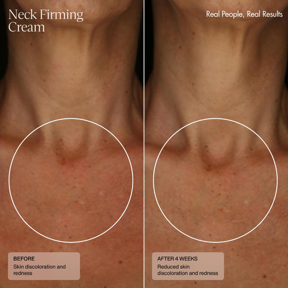 Senté Firming Neck Cream for Crepey Skin & Vertical Lines | Lifts, Firms & Smooths Neck & Décolleté | HSA, Caffeine, Vitamin C | 1.7 Fl Oz