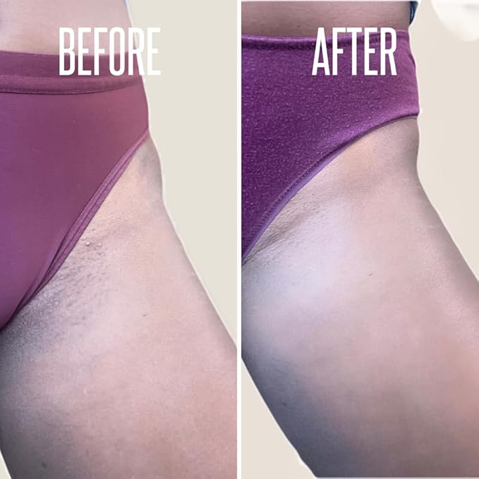 Save 14% on The Skin Care Solution For Dark Spots, Razor Bumps, Ingrown Hair & Razor Burns β Includes Our Ultra Potent Brightening + Razor Bumps Solution For an Ultra Clear & Glowing Skin