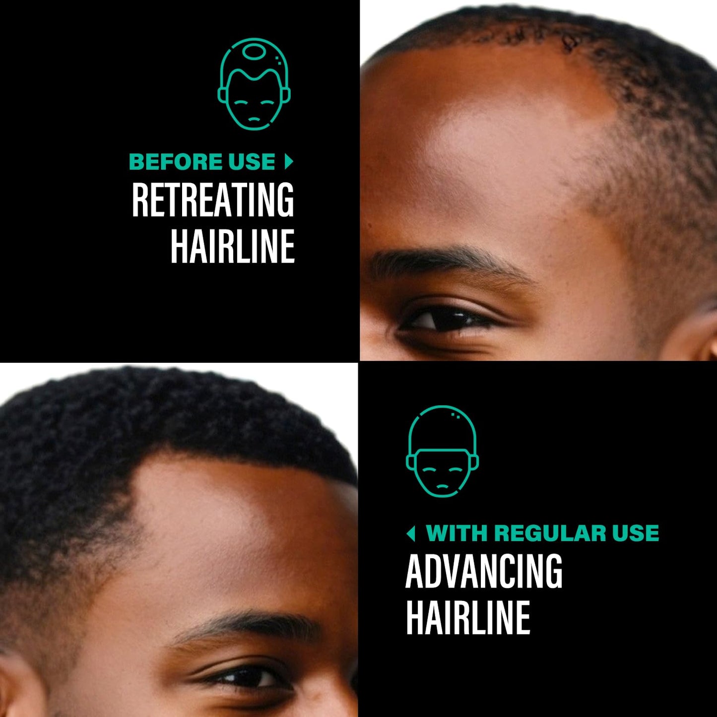 Unrefined Batana Oil for Hair Growth - Authentic & Organic Dr Sebi Batana Hair Mask from Honduras - Natural Hair Growth Oil - 4 Ounce Jar