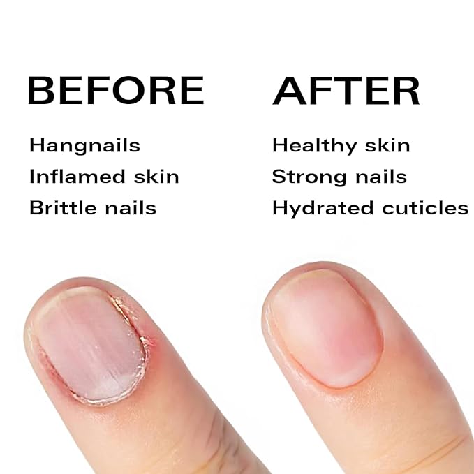 Nail Oil Cuticle Pen - Strawberry - Nail Strengthener & Growth Serum with Vitamin A, D, E, B5, Grapeseed & Natural Oils - Repair for Brittle, Peeling, Thin Nails - Twist Brush Pen