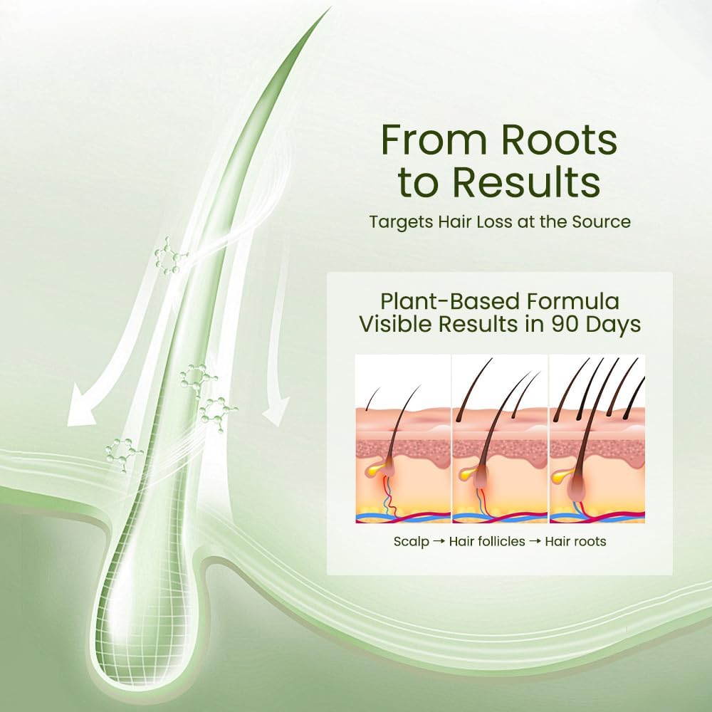 0.5% KX-826 DHT Blocker Hair Thickening Growth Products,Plant-Based Extract Essence Anti-Hair Loss Solution,Hair Spray,3 Days Oil Control 1-2 Weeks Hair Loss Reduction 3-6 Months New Hair Visible