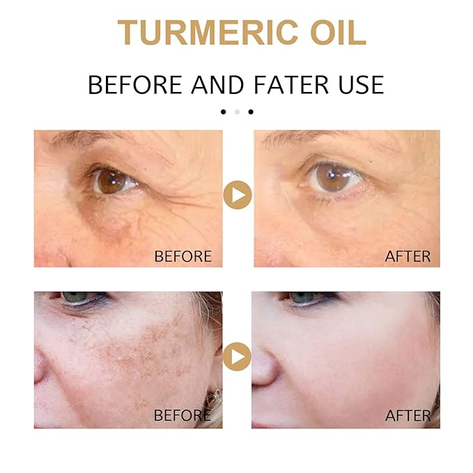 3PCS Turmeric Dark Spot Corrector Serum Oil,Turmeric Repair Face Serum, Natural Turmeric Skin Dark Spot Skin Care Moisturizing Repair Serum,Turmeric Serum for Face & Body(30ml)