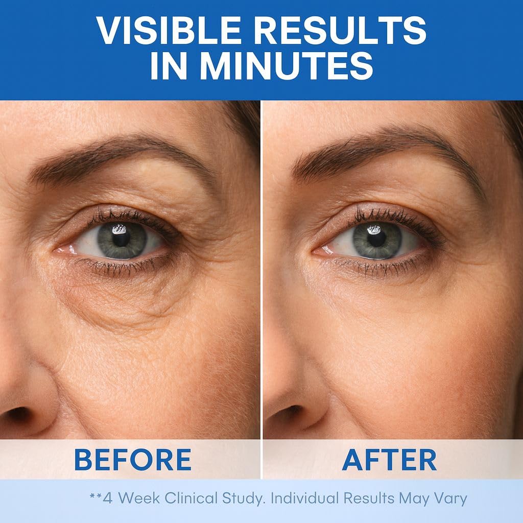 Instant Under Eye Lift Serum – Reduces Puffiness, Eye Bags & Wrinkles in Minutes | Advanced Firming Polysaccharide Formula for Mature Skin | Anti-Aging Under Eyes Treatment 20 mL