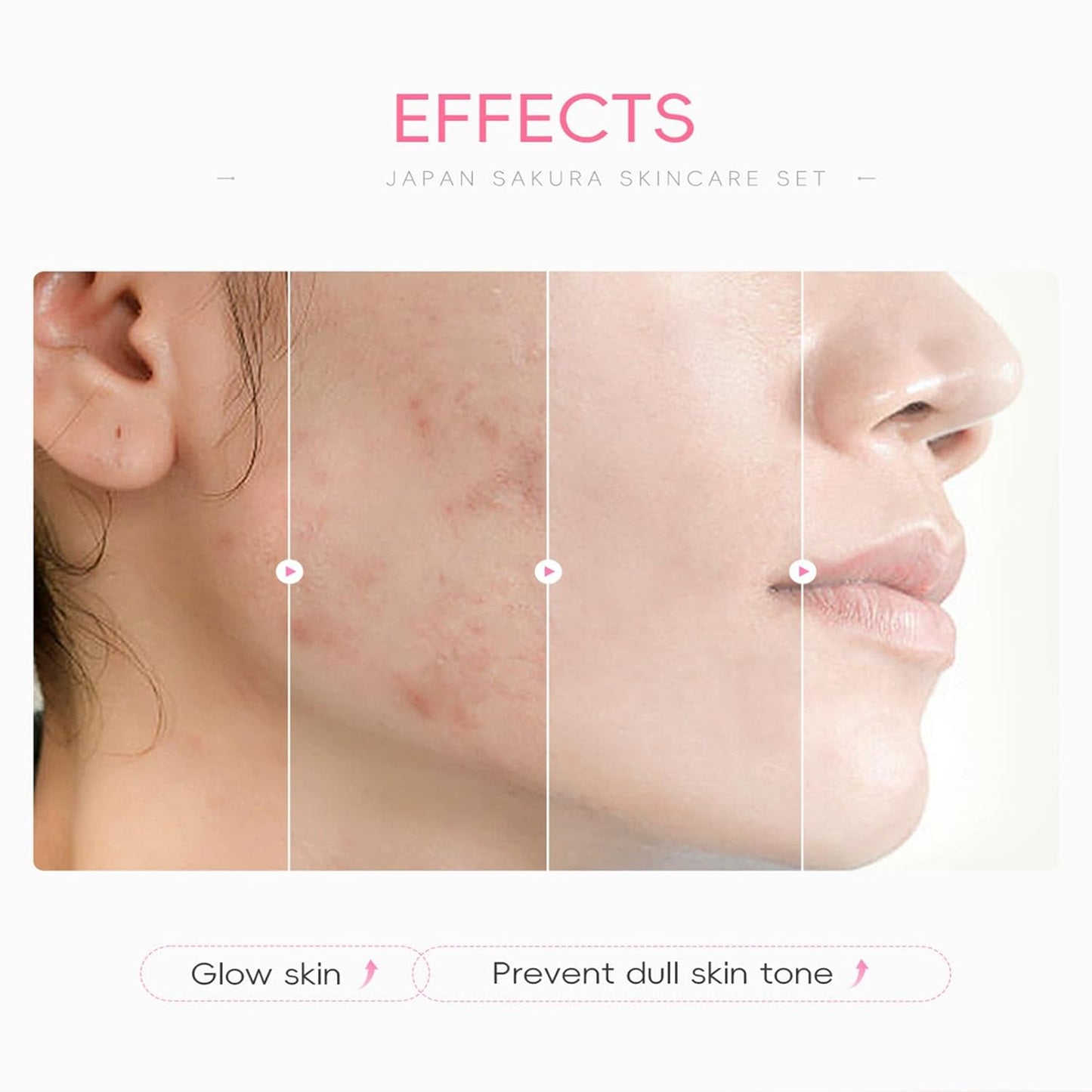 Skin Care Set with Cute Mini Luggage,Sakura Skin Care Sets & Kits,Pamper Sets For Teenagers Girls Gifts,Skin Care Set For Teenagers Girls 10-12 (One Size, Cherry Blossom-StyleC-Advanced Moisturizing)