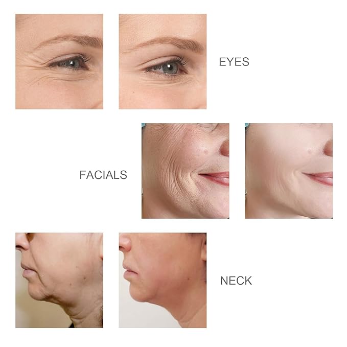 Face Skin Tightening Device - Radio Frequency Facial Firming Machine Microcurrent Lifting Massager Anti-Aging Removing Wrinkles Puffiness Skin Care Toning for Face Neck Eyes, Beauty Products, FM-BMJ03