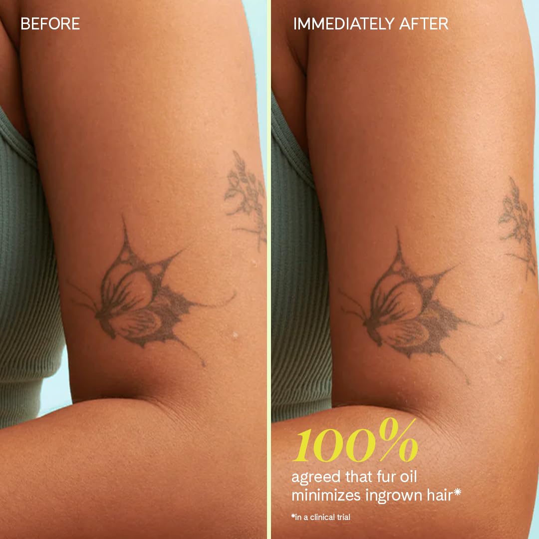 Fur Oil - Prevent Ingrown Hairs - Moisturize and Soften Dry Skin - 2.5fl oz with Ingrown Eliminator Mitt