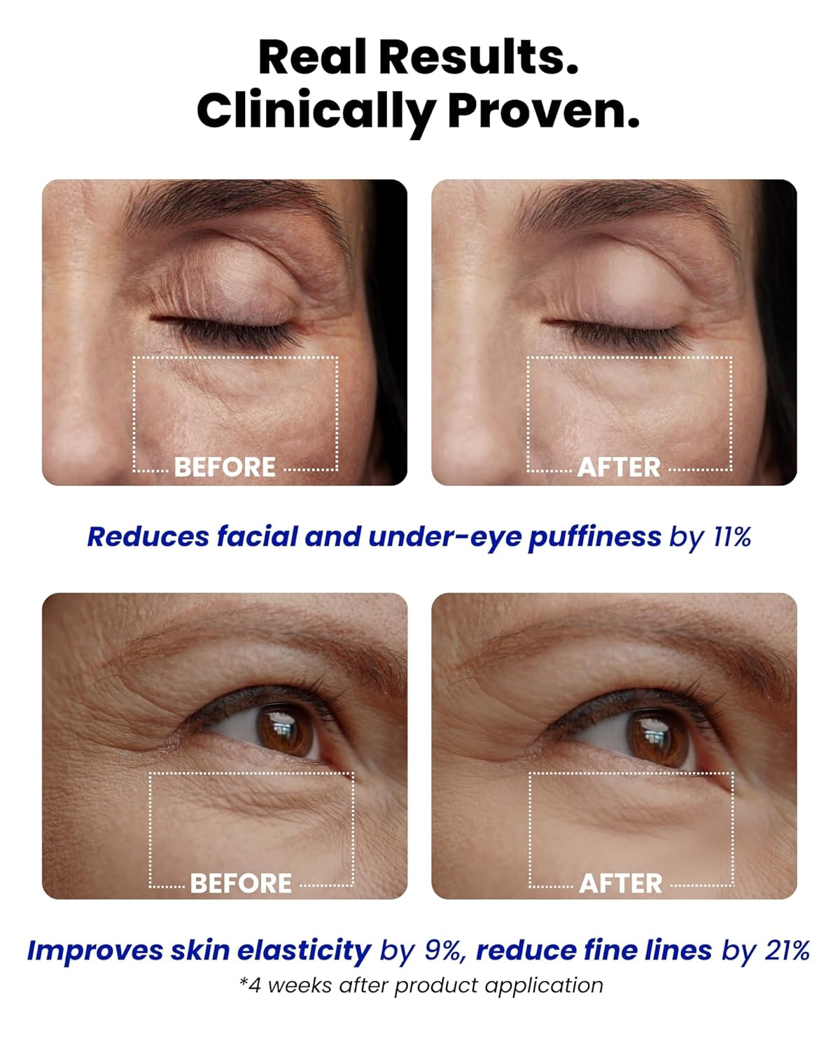 Ice Roll Serum - Cooling Serum with Face Massager Roller for Under Eye Bags, Puffiness, Dark Circles, Bakuchiol & Collagen for Wrinkles, Anti Aging, Firming - Korean Skin Care, 1.69 Fl Oz (50ml)