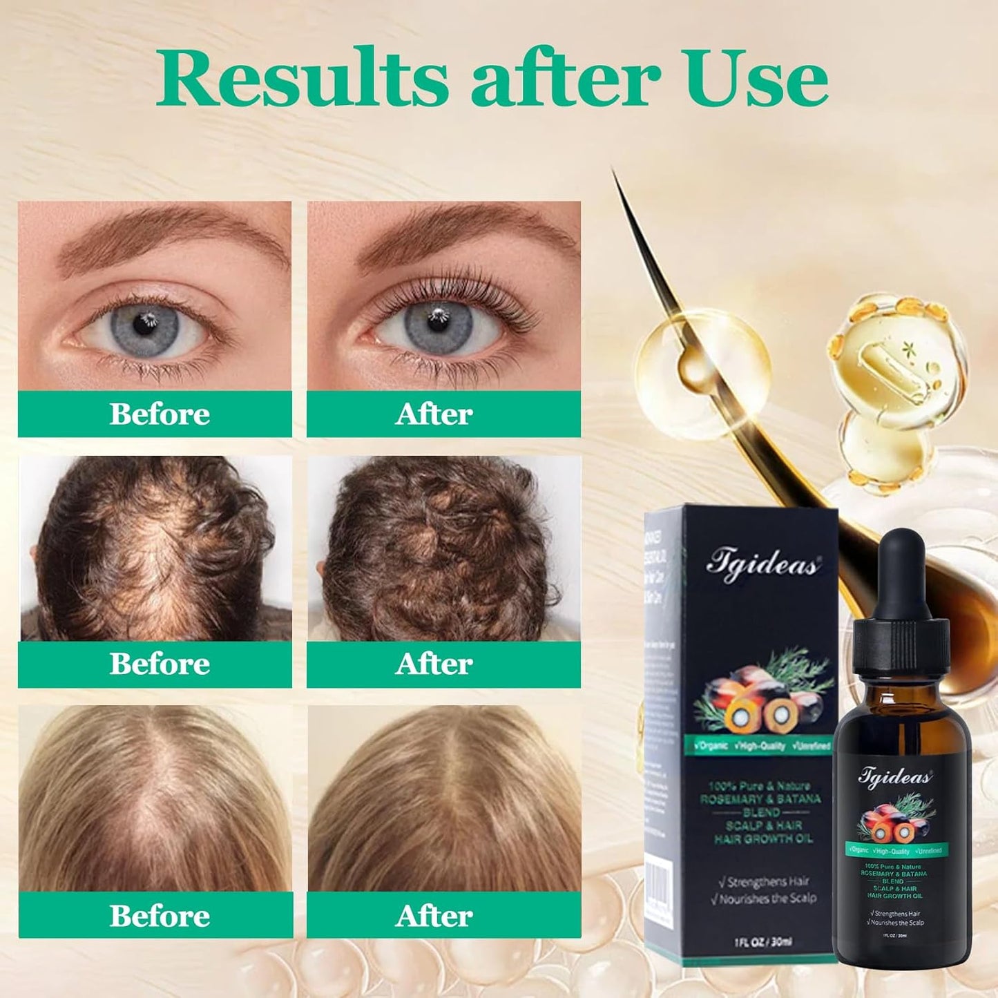 Tgideas Rosemary Batana Oil - Organic Hair Growth - for Scalp & Hair Strengthening - All Hair Types Treatment Oil - Eyebrow & Eyelash Nourishing - 2 Packs
