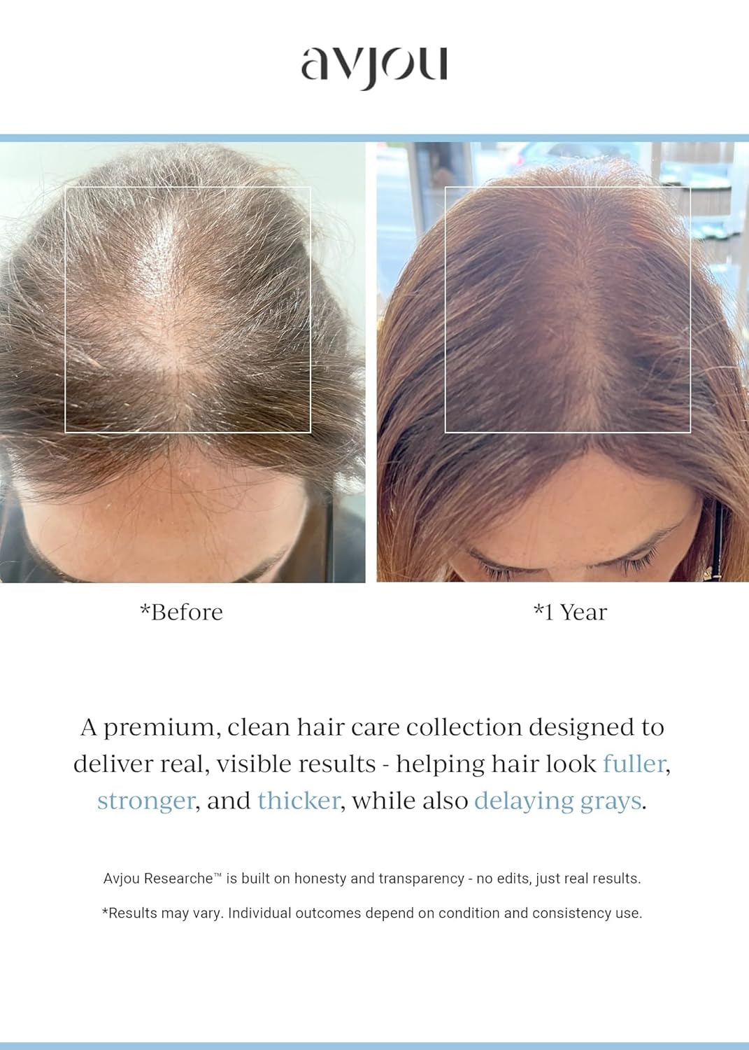 Avjou Researche™ Scalp Serum – Thicker, Fuller-Looking Hair + Targets Visible Signs of Premature Greying – 3 Patented Ingredients – Backed by Cosmetic Science – Oil-Free, All Hair Types, 1.7 oz