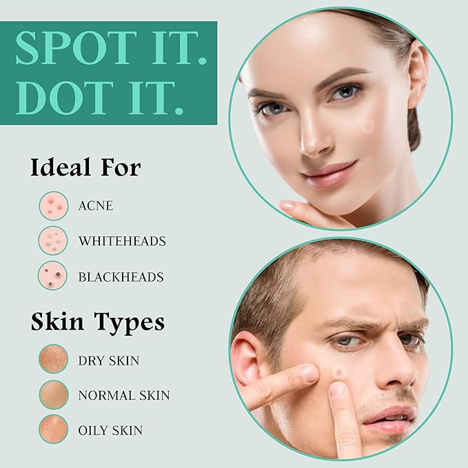 Advanced Invisible Pimple Patches for Face (96 Pack) - Hydrocolloid Patches with Tea Tree Oil - Vegan Friendly Acne Patches for Face - 2 Size Pimple Patch Stickers (10mm, 12mm)