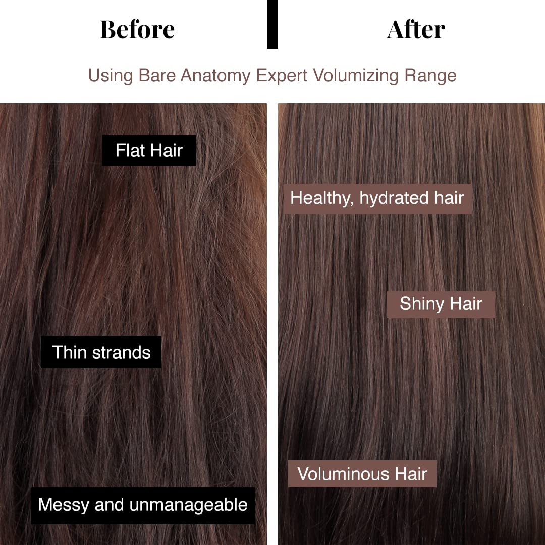 Bare Anatomy Volumizing Shampoo | Volume For Upto 24 Hrs | Strong & Bouncy Hair | Volume Shampoo for Thin Hair | Paraben & Sulphate Free | Women & Men | 8.4 Ounce