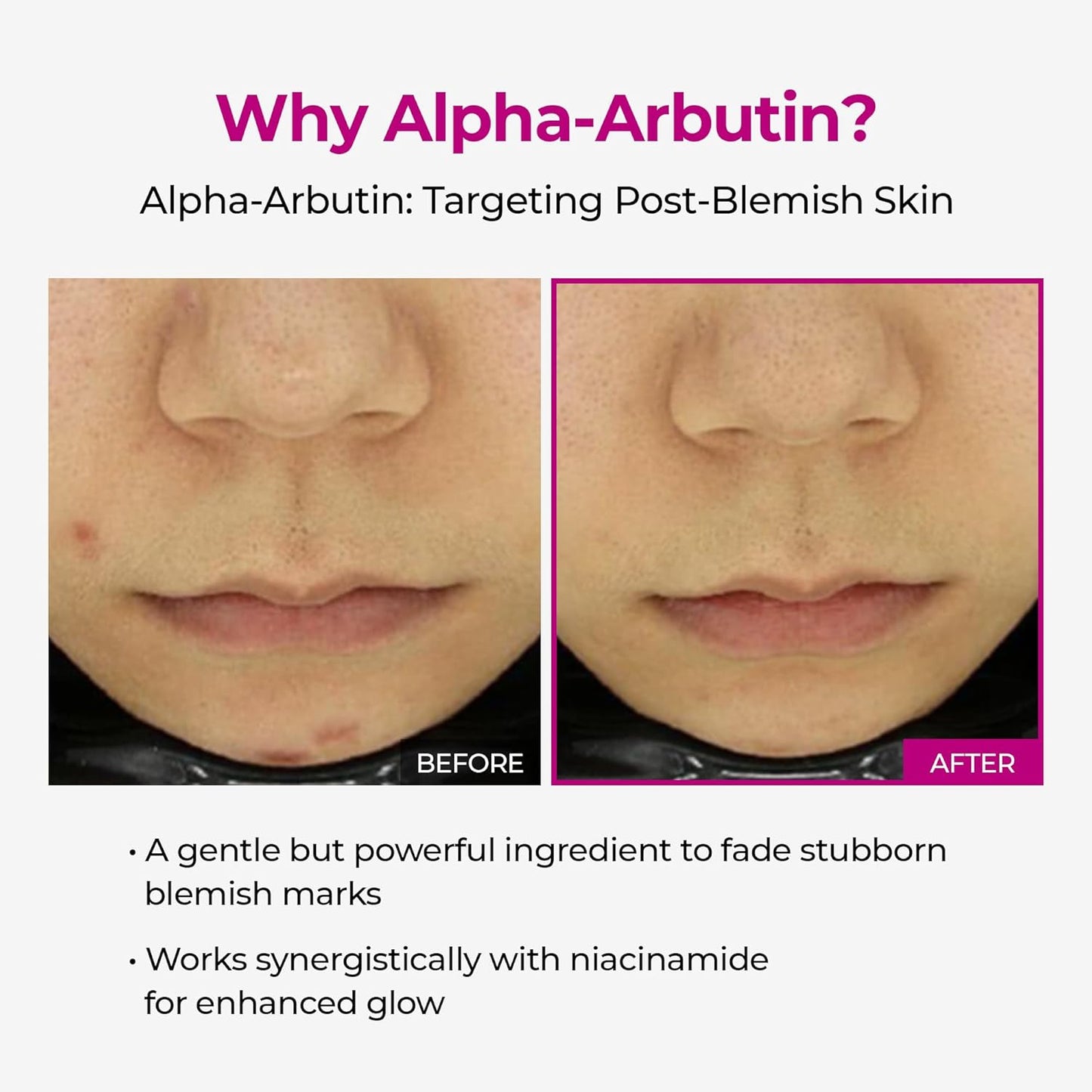 Dr.Melaxin Cemenrete Picotonic Shot Calcium Ampoule for Even Skin Tone & Skin Clarity Anti-aging Dark spot care 1.01 fl.oz.