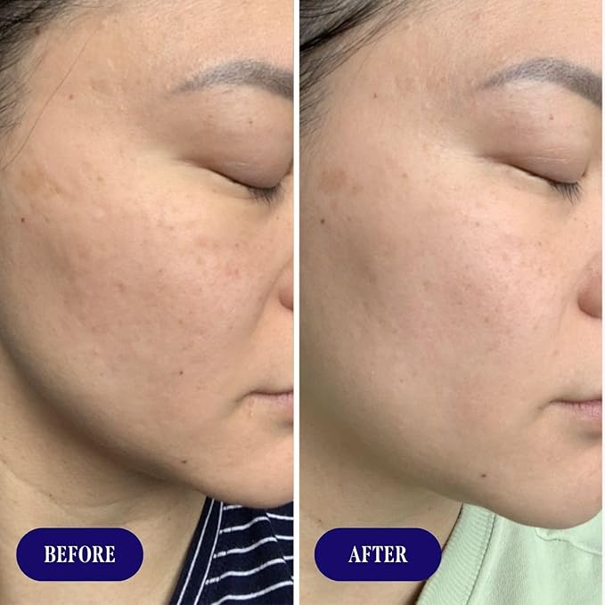 Three Ships Dew Drops Hyaluronic Acid And Vitamin C Serum - Vegan Facial Serum Brightens And Plumps Skin - Intensive Natural Face Serum for All Skin Types- As Seen on Dragon’s Den, 01 Fl Oz