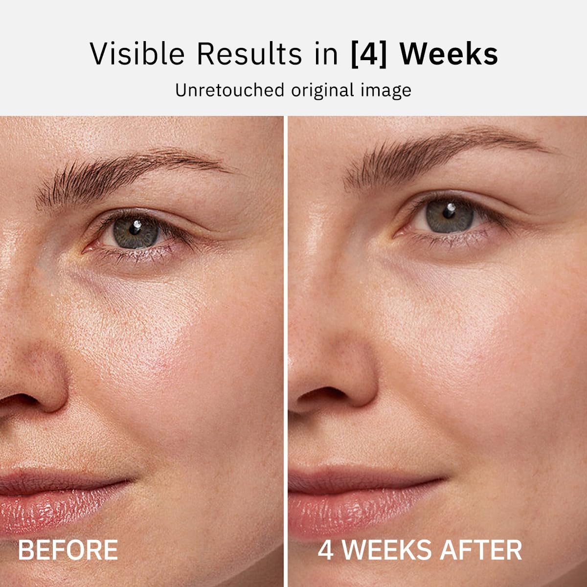 HKH Vitamin C Serum for Face: 48 Capsules Retinol Anti-Aging Wrinkle Repair Serum - Vitamin E Niacinamide Oil for Women - Daily Deep Skin Care for Fine Lines Smoothing Hydrating Brightening