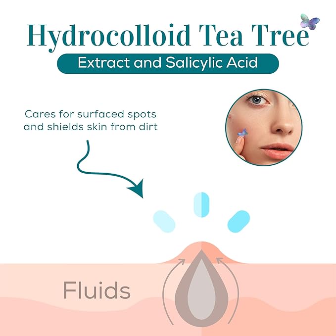 My Beauty Spot Pimple Patches Cute Acne Patches for Face 20 Pcs with Tea Tree Extra & Salicylic Acid, Butterfly, Daisy and Rainbow Colorful Fun Designs – Pimple Patches for Face Acne Spot Treatment