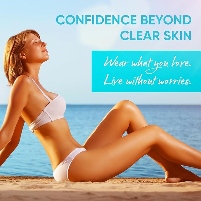 Butt Acne Clearing Treatment Cream: Clears & Prevents Breakouts Fast – Gentle Body & Back Lotion for Clogged Pores, Folliculitis & Bumps, 2% Salicylic Acid & Niacinamide, Ideal for Women, Men & Teens