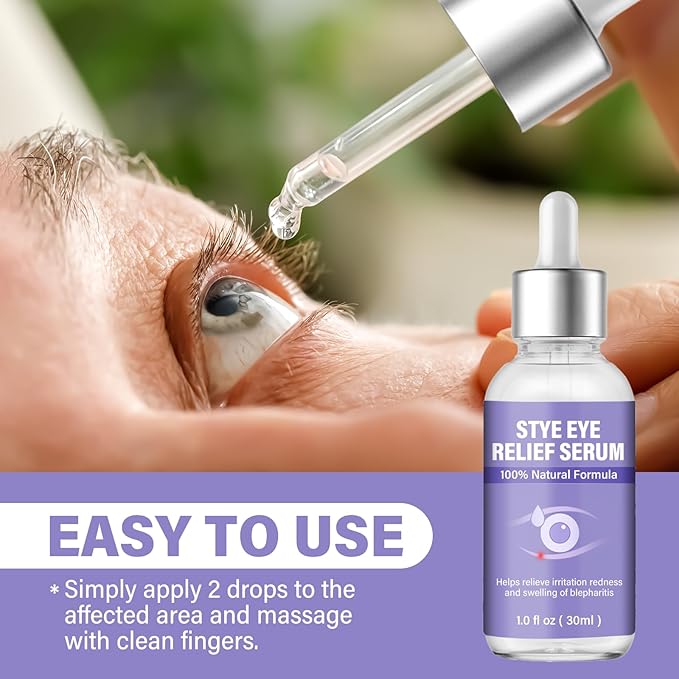 Stye Eye Treatment, Natural Stye Relief Serum, Gently Cleanses Lashes and Eyes, Chalazion and Blepharitis Treatment,Relieves Eye Irritation