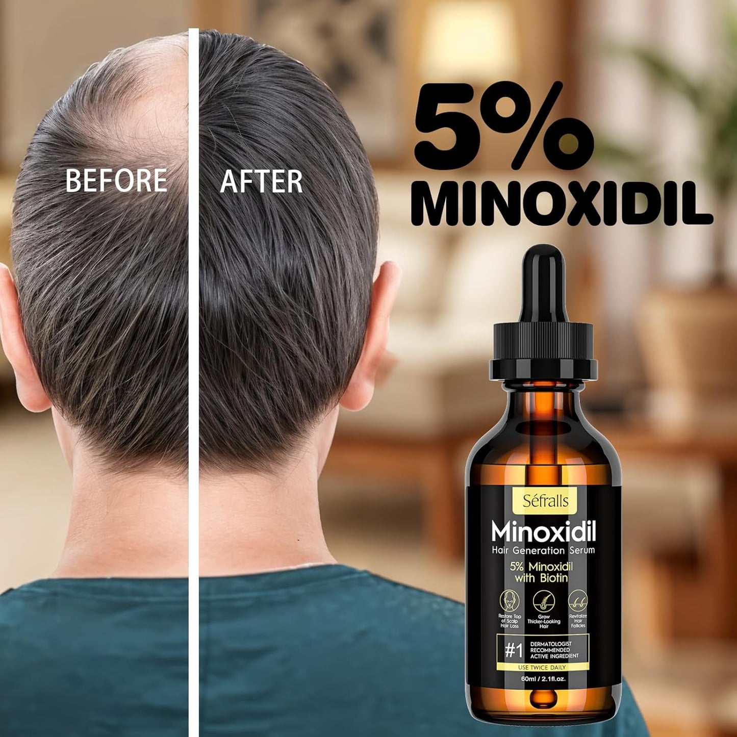 5% Minoxidil Hair Growth Serum Oil For Men and Women, Biotin Hair Serum, Safest Hair Regrowth Treatment, Prevent Scalp Hair Loss 60ml / 2.11 fl.oz