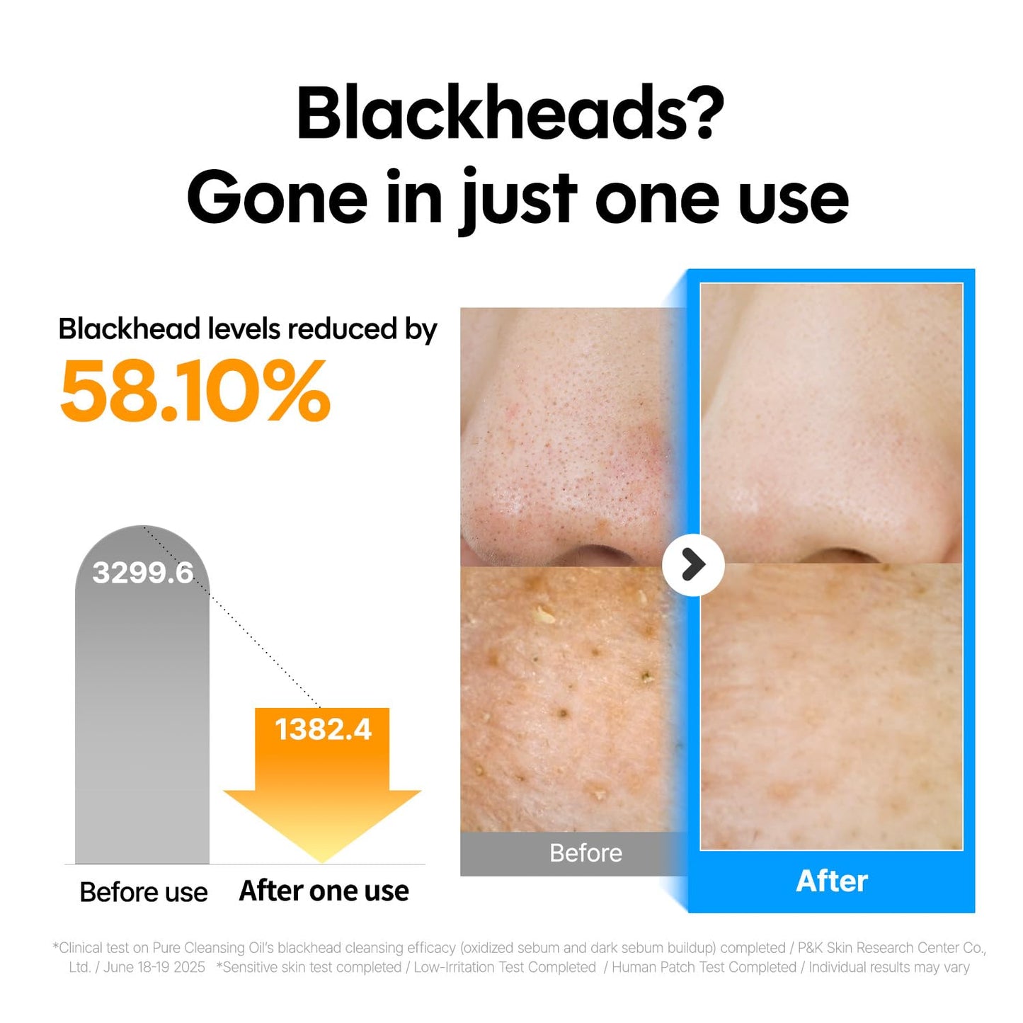 ma:nyo Pure Cleansing Oil, Natural Oil Cleanser for Face, Makeup Blackhead Remover, Korean Skin Care, 6.76 fl oz (200ml)