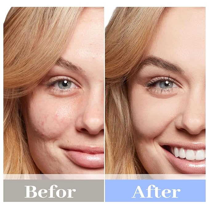 Chlorella Deep Hydrating Mask, with Collagen and Hyaluroic Acid-Sheet Facial Mask Skincare with Chorella Vulgaris Extract, Hydrating, Firming,5ea