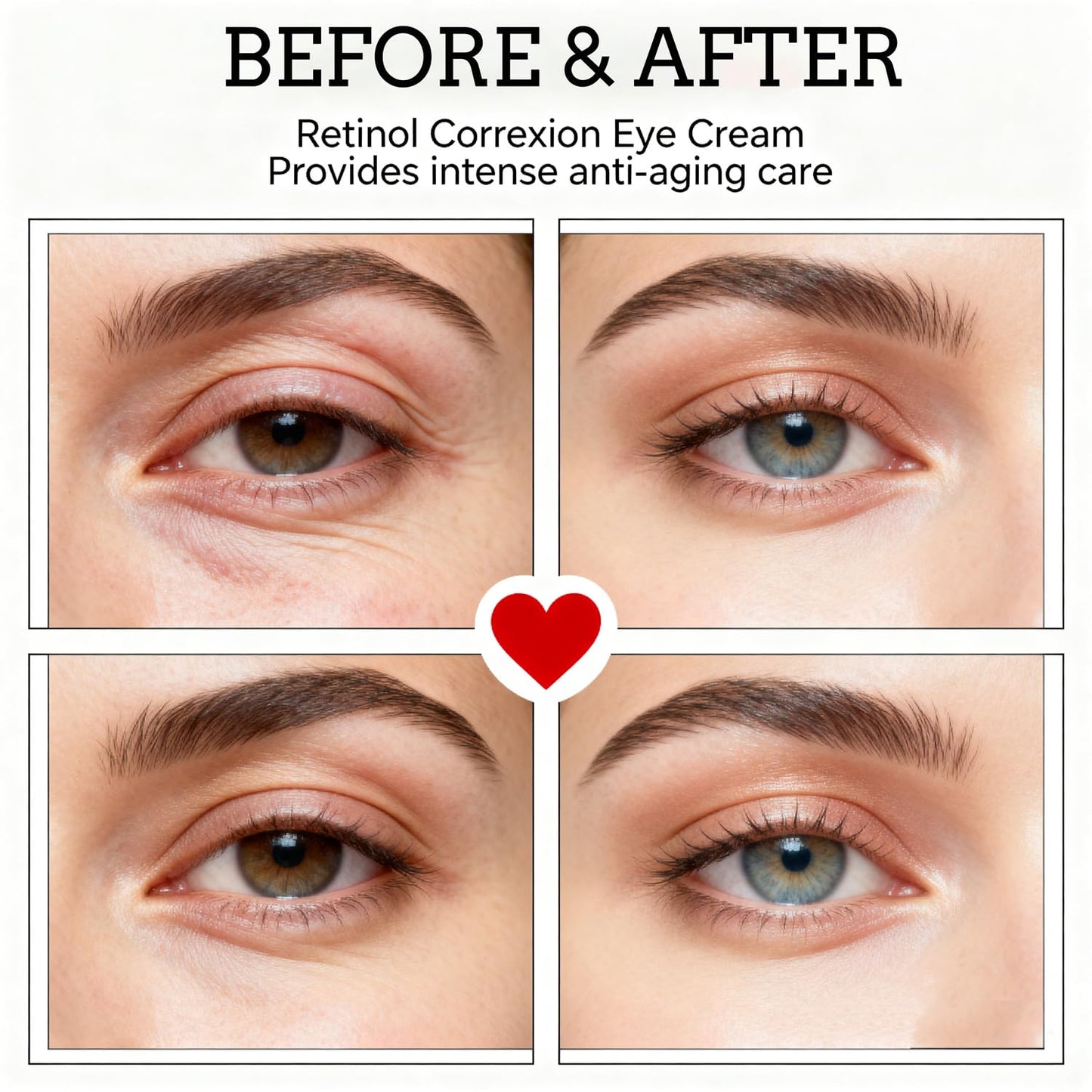 Retinol Eye Cream with Niacinamide, Hyaluronic Acid & Vitamin E – Hydrating Under Eye Cream for Visible Dark Circles, Wrinkle Appearance & Under-Eye Fullness, Anti Aging