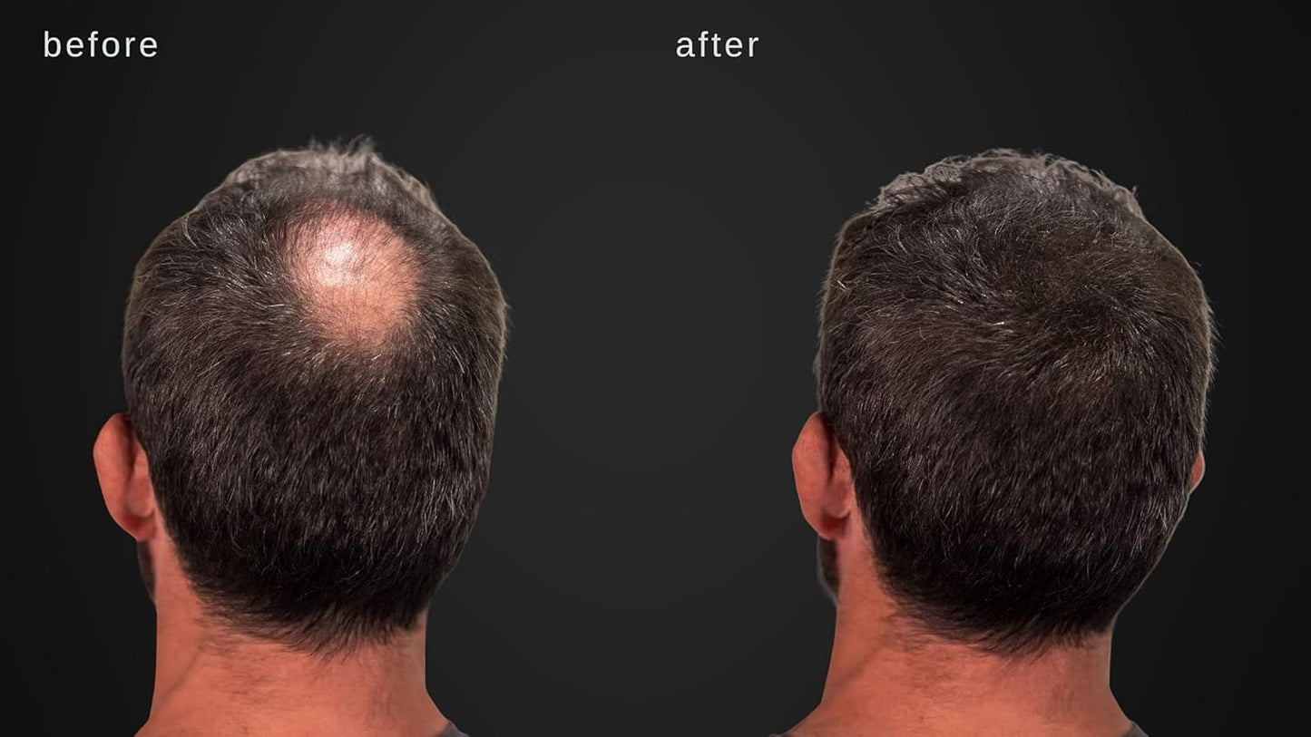 Volumizing Hair Fibers with real Keratin for Thinning Hair/Hair Loss – Dermatologist Tested and Certified Hypoallergenic - 60 days + supply - Multiple Colors Available (Gray)