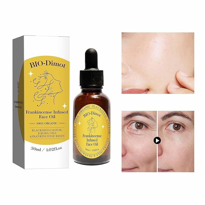 Frankincense Resin Oil For Face,Frankincense Resin Infused Organic Black Seed & Jojoba Oils,Natural skin Care moisturizing, Facial Anti-Aging Moisturizing skin Serum (1)