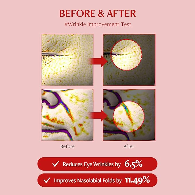 Shumage Gold Seal Lifting Cream+Device & Shumage Shot Gold Seal Lifting Ampoule - Moisturizer Face Lift Cream, Hydrating & Tightening for Sagging Skin - Collagen Serum for Radiant Glow