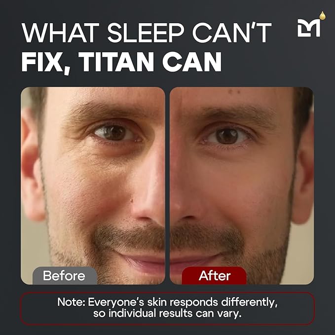 Titan Mens Eye Cream Anti Aging Bags & Dark Circle - Eye Bags Treatment for Men, High Potency Wrinkle Cream for Men, Herbal Extracts, Peptides for All Skin Types - Unscented, 0.5 Fl Oz