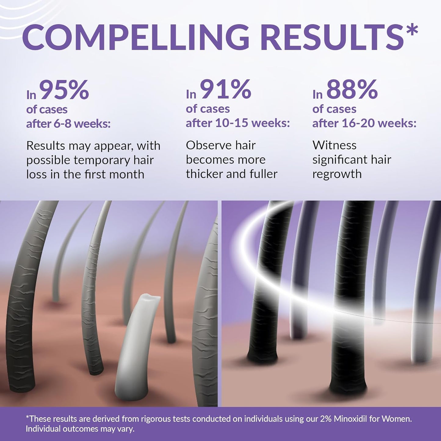 Minoxidil for Women 2% - Hair Growth Serum Women + Vitamin E, Ginseng, Ginger Extract, Biotin Hair Growth Serum - Hair Loss Regrowth & Thickening Treatment Helper