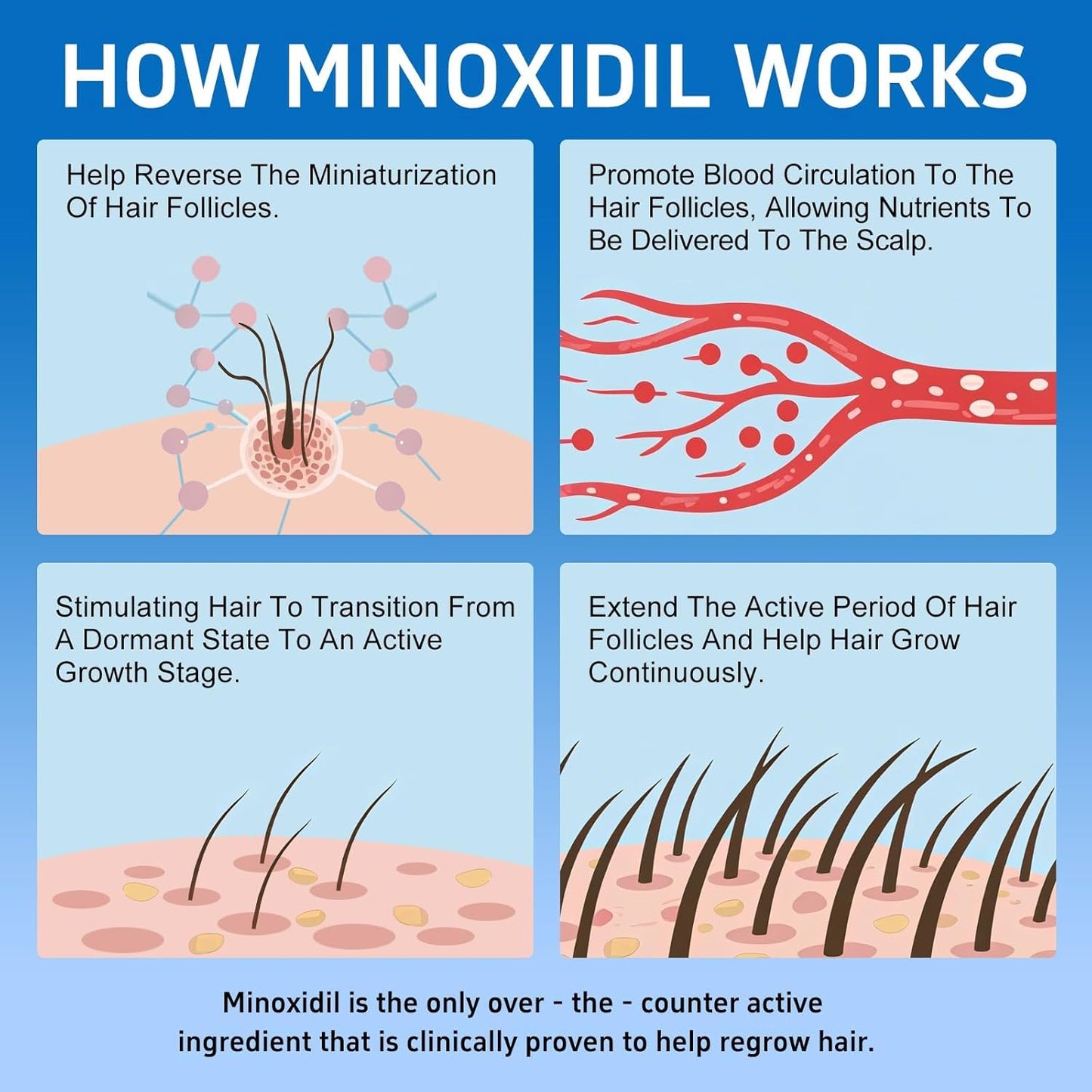 6 Packs, 5% Minoxidil with Biotin, Hair Growth Treatment, Minoxidil Hair and Beard Growth Oil, Minoxidil for Men and Women, Supports Thicker and Fuller Hair & Beard (12 fl oz, 6 Month Supply)