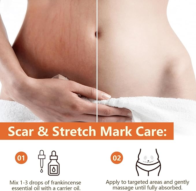 Premium Frankincense Essential Oil 2PCS– 100% Pure & Natural, Therapeutic Grade for Skin, Face & Aromatherapy | Best Frankincense Oil for Face, Wrinkles & Scars | Deeply Nourishing