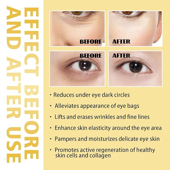 Eye Roller for Puffy Eyes, Castor Oil and Frankincense Eye Roller for Dark Circles, and Wrinkles, Anti Aging Eye Serum Cream, Glass Bottle, 2 PCS