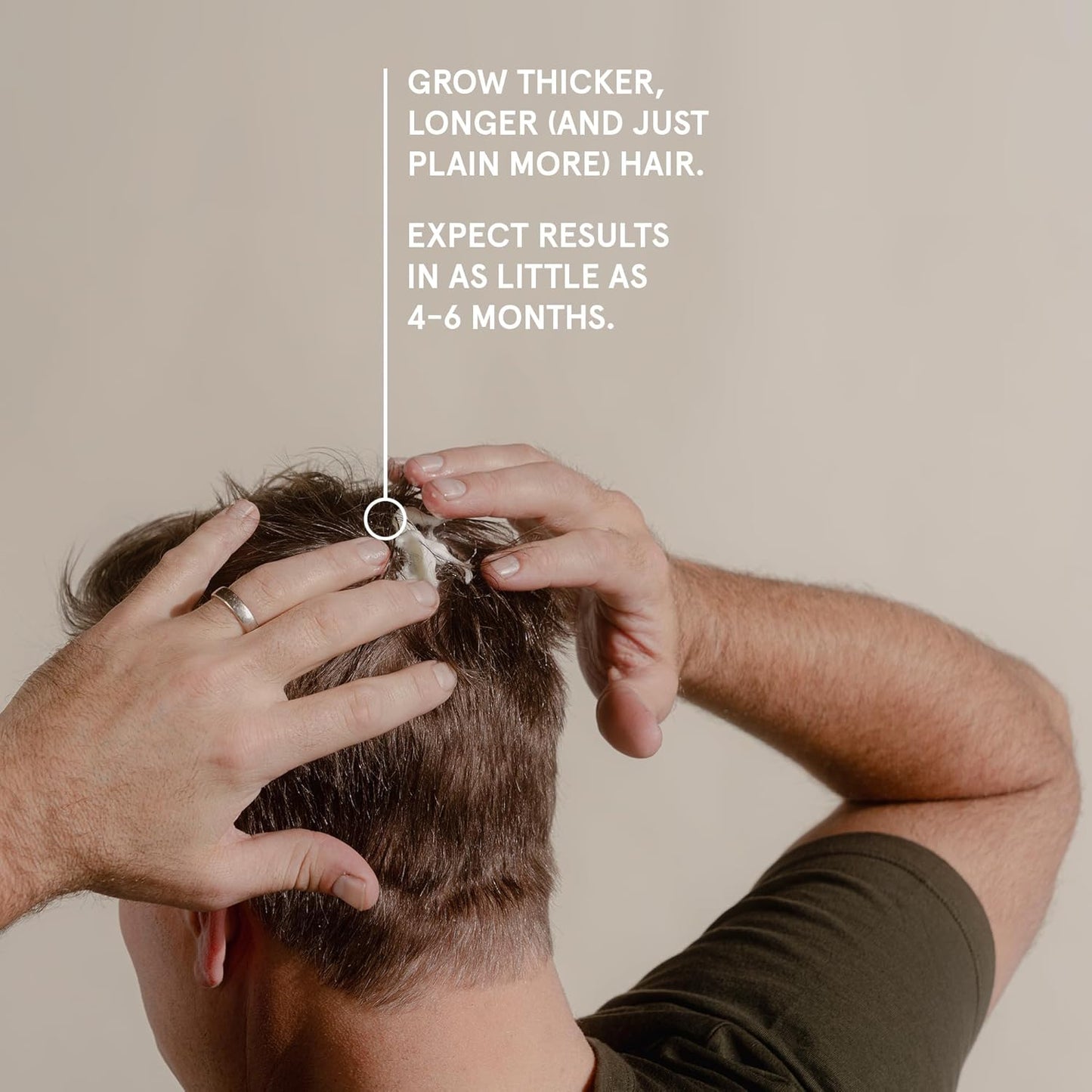 Keeps Extra Strength Minoxidil for Men - 5% Minoxidil Foam Hair Loss & Regrowth Treatment for Thinning & Bald Spots - Clinically Proven Hair Growth Products - Unscented Topical Aerosol Foam