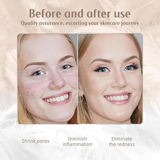 Red-Light-Therapy-Wand-for-Face, 7 Colors LED Light Therapy Wand Eye Facial Red & Blue Rejuvenation Tool, Face Massager, Golden