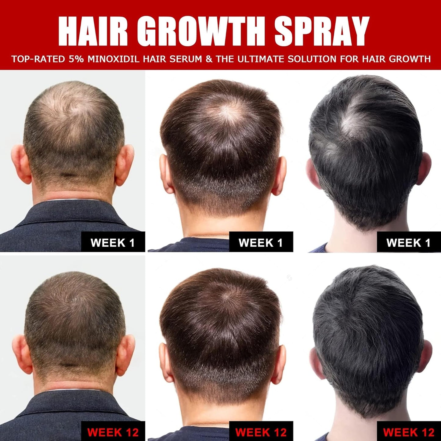 Hair Growth Spray by Ceessting- Biotin, Caffeine and Niacinamide - Anti-Hair Loss for Thinning Hair -Hair Regrowth Treatment for Men and Women- 2 Ounces