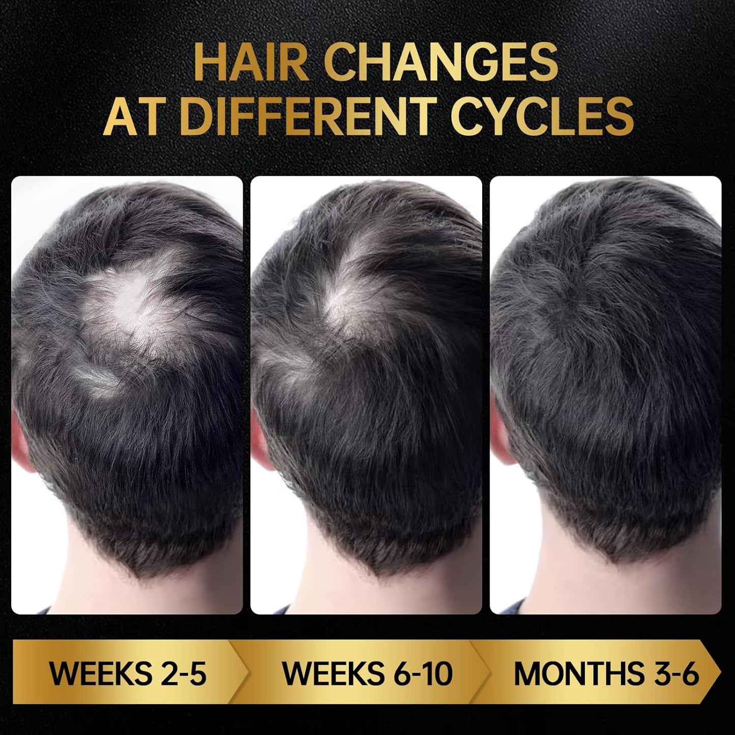 Minoxidil for Men & Women, With Biotin, Batana Oil, Rosemary Essential Oil, Effective Hair Loss Solution, Hair Loss Treatment for Hair Regrowth, Non-Greasy 5% Minoxidil - 60ml