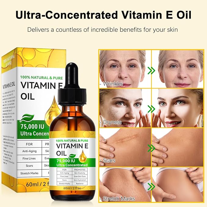 Vitamin E Oil for Skin, Hair & Face -75000 IU, Natural, Pure & Organic Vitamin E Drop Liquid for Scars, Nails, Scalp, Bath & Body Oil, Moisturizing Dry Skin, 2Oz