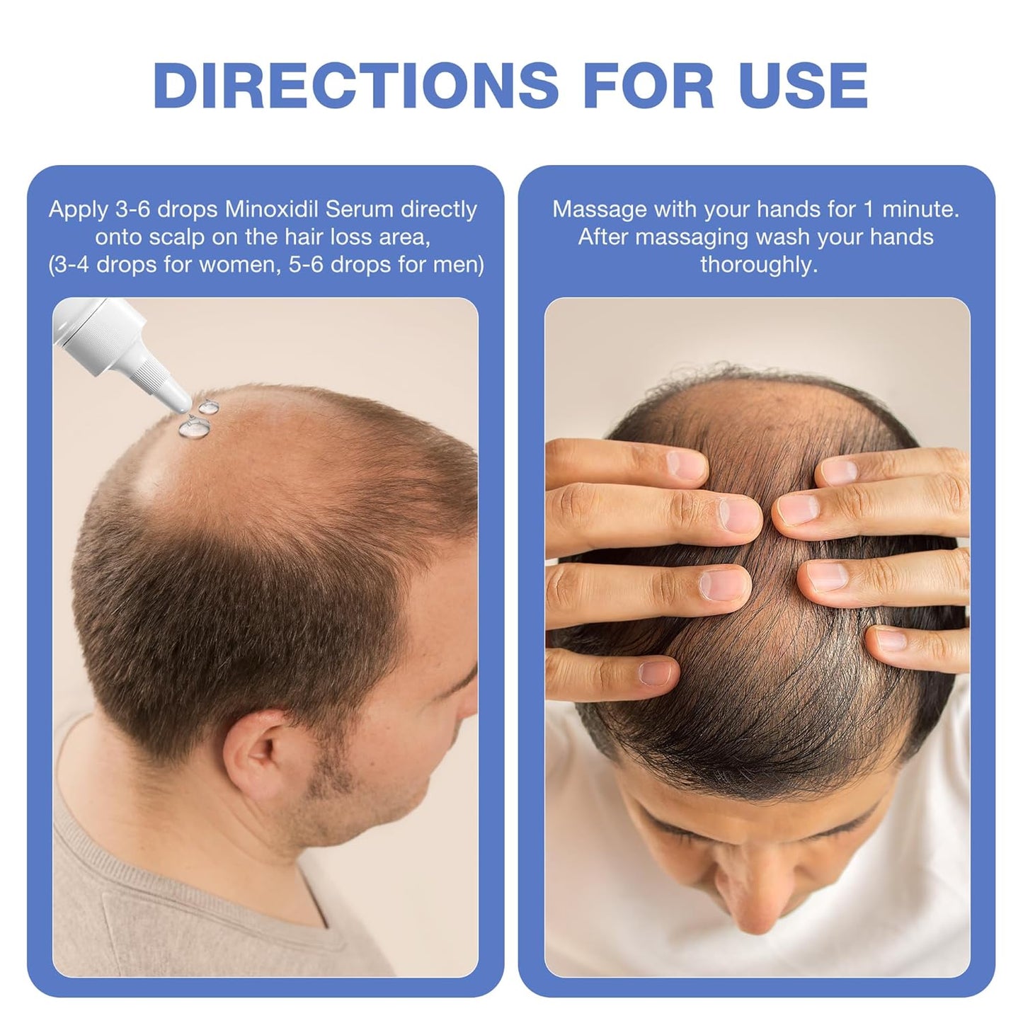 5% Minoxidil for Men, for Men & Women Hair with Biotin, Minoxidil for Beard Growth for Hair Loss to Hair Regrowth Get Thicker Fuller, Hair Loss Treatments for Women 100ml