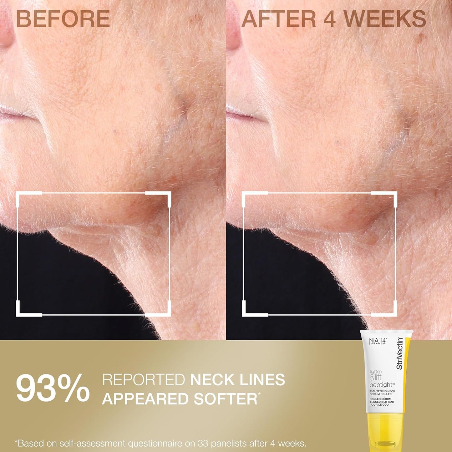 StriVectin Tighten & Smooth Neck Cream and Neck Serum Roller Anti-aging Skin Care 2-Piece Set, Smoothing Look of Wrinkles and Fine Lines, Improves Crepey Skin and Vertical Lines