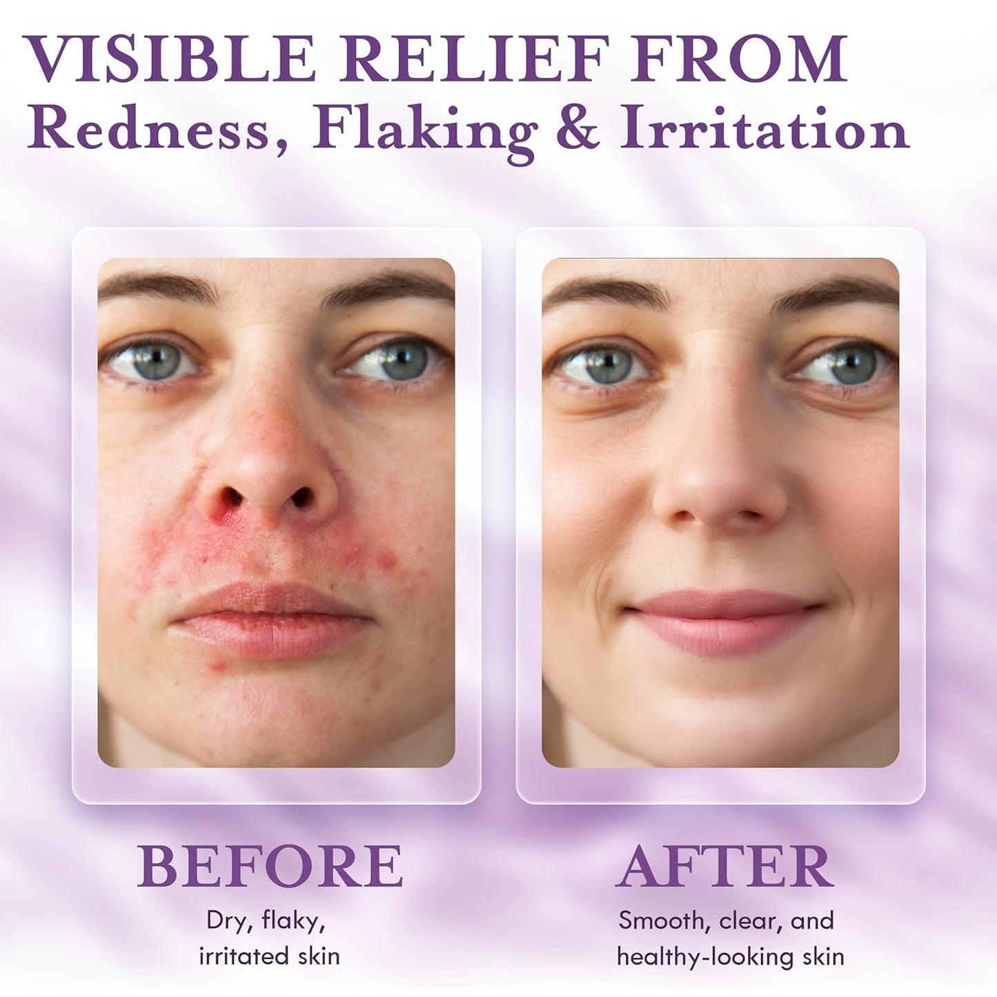 DERMAdoctor Tranquility Cleanser Dermatologist Formulated 2% Pyrithione Zinc for face body & Scalp - 7.10 oz