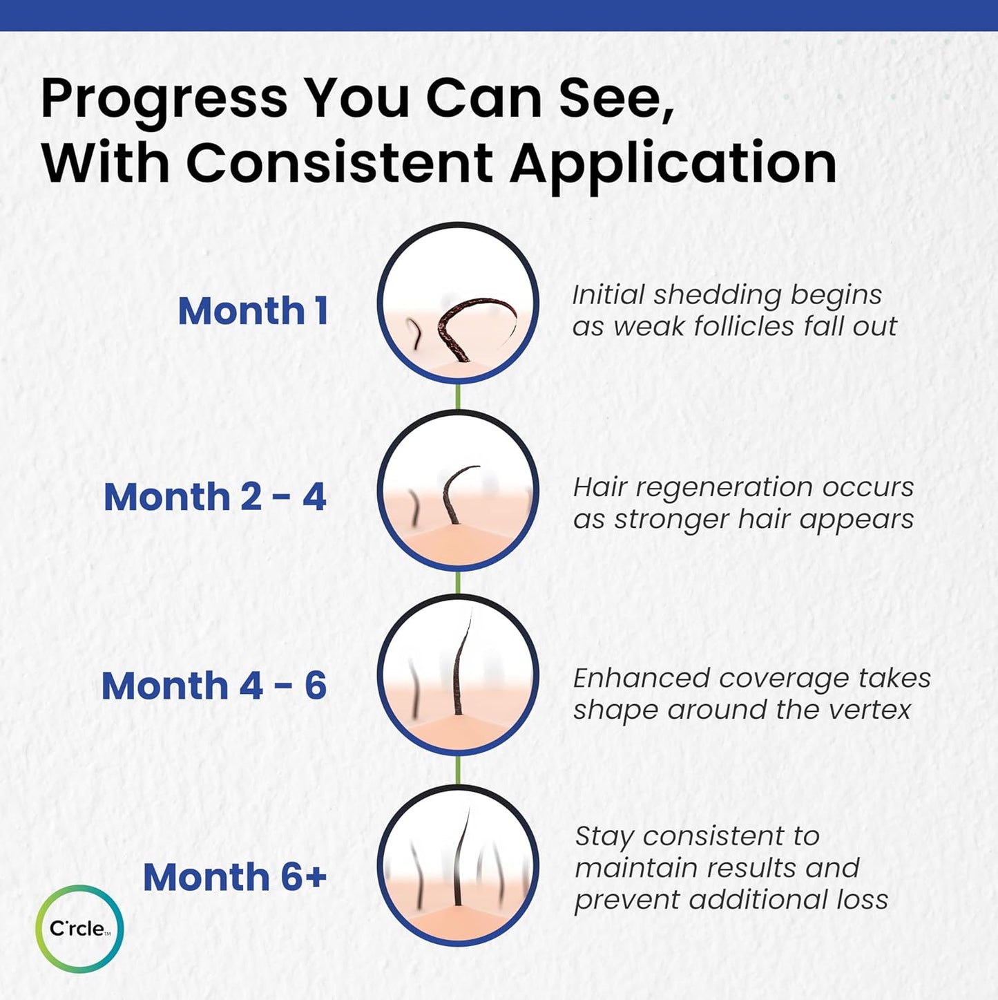 Minoxidil for Men Foam 5% - Unscented 3 Month Supply - Helps Restore Vertex Hair Loss & Thinning - 5% Minoxidil Foam For Men - Extra Strength Supports Hair Regrowth