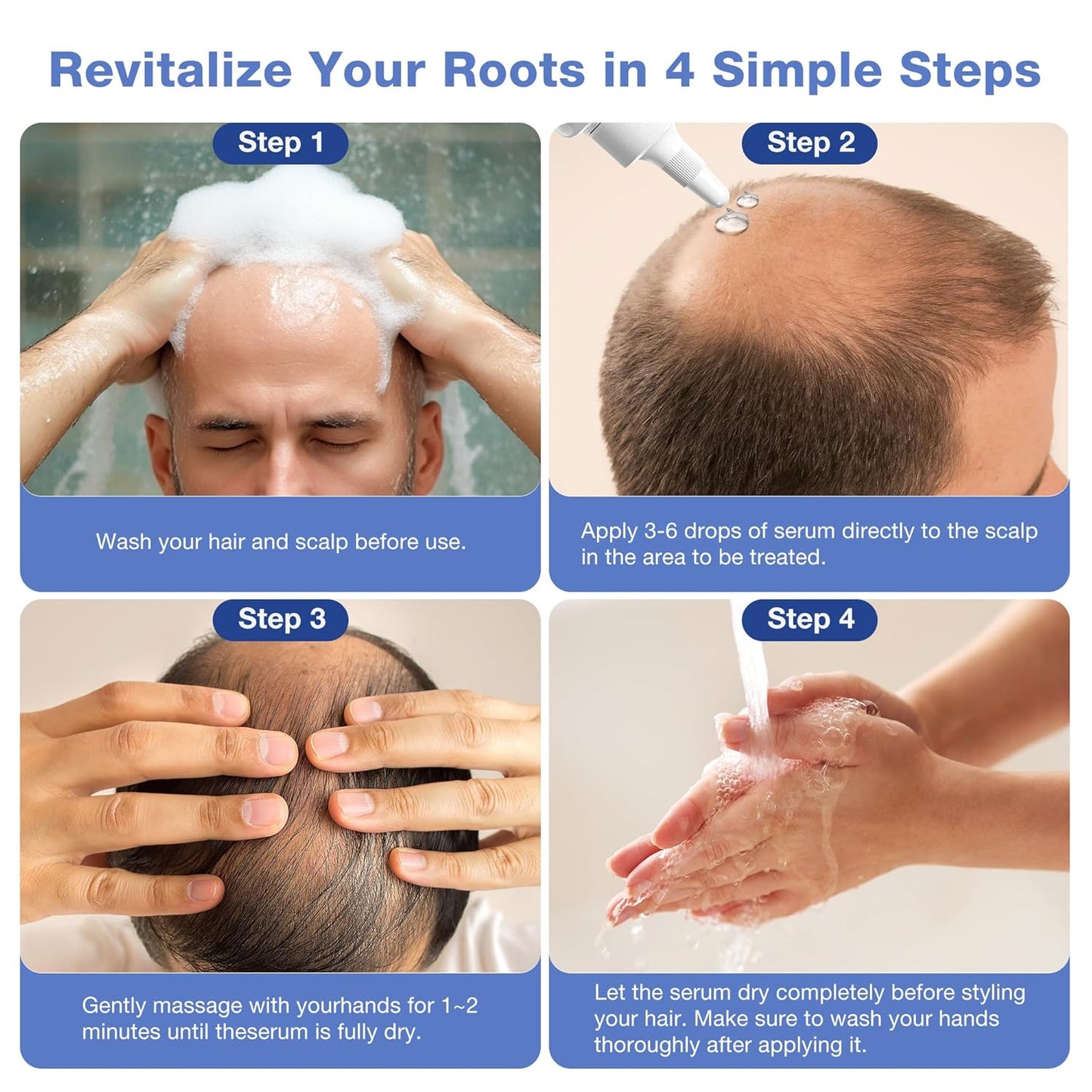 5% Minoxidil with Biotin Hair Growth Serum for Men & Women – Thicker & Healthier Hair, Topical Minoxidil to Restore Fuller Beard, 200ml (100ml×2) with Extra 80ml Volume