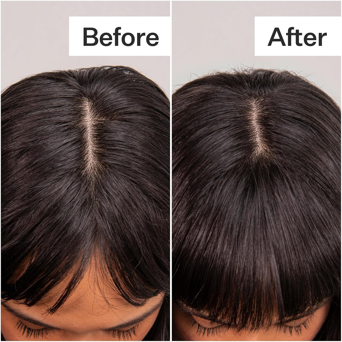 ACT+ ACRE Plant-Based Fulvic Acid Volumizing Dry Shampoo - Natural and Unscented Powder Spray Shampoo with Fulvic Acid and Rice Refresh Oily Hair and Restore Volume - Dry Shampoo for All Hair Types