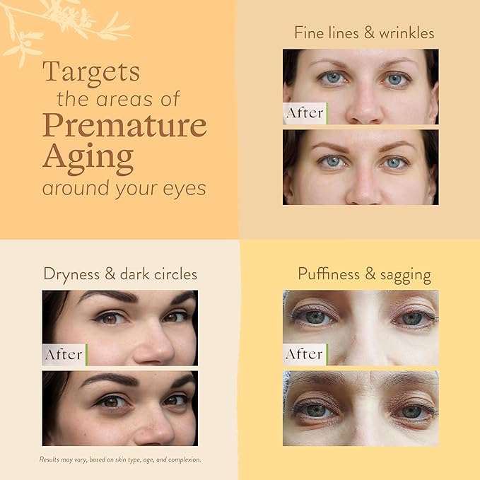 LILY SADO CITRUS KISSโข Eye Repair Cream - Antioxidant-Rich Natural Formula w/Peptides, Sodium Hyaluronate, and VITS C, B5 & E - Prevents Puffiness, Under-eye Wrinkles, Discoloration & Eye Bags - 1oz