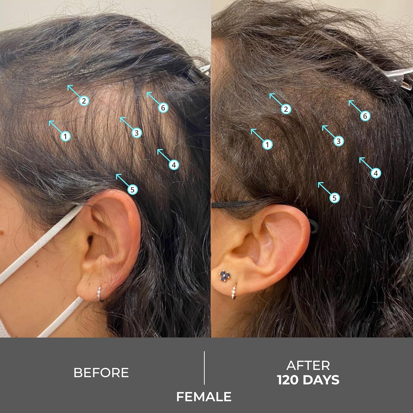 DS Labs Revita Extra Strength Shampoo, 205mL – Scalp First Cleanse for Fuller, Thicker Looking Hair, Lightweight Hydration, Sulfate Free, Color Safe, For Men & Women