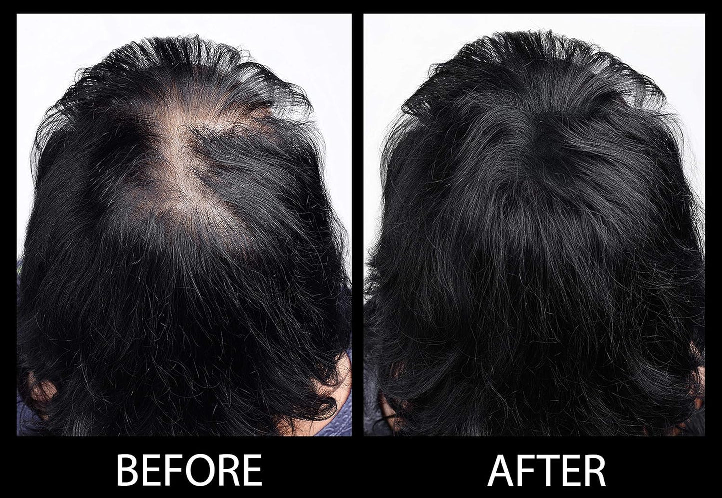 Volumizing Hair Fibers with real Keratin for Thinning Hair/Hair Loss – Dermatologist Tested and Certified Hypoallergenic - 60 days + supply - Multiple Colors Available (Black)