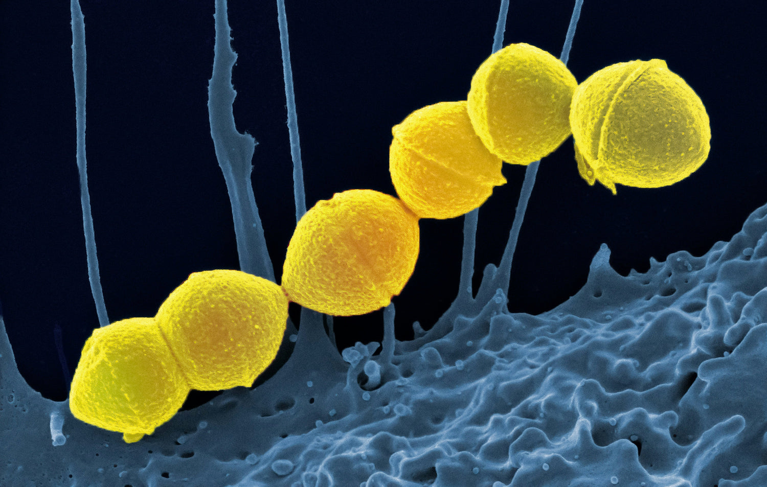 Immune Boosters