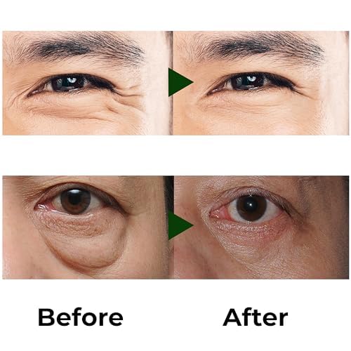Abera Ultimate Men’s Eye Therapy – Hydrating & Firming Eye Care Solution